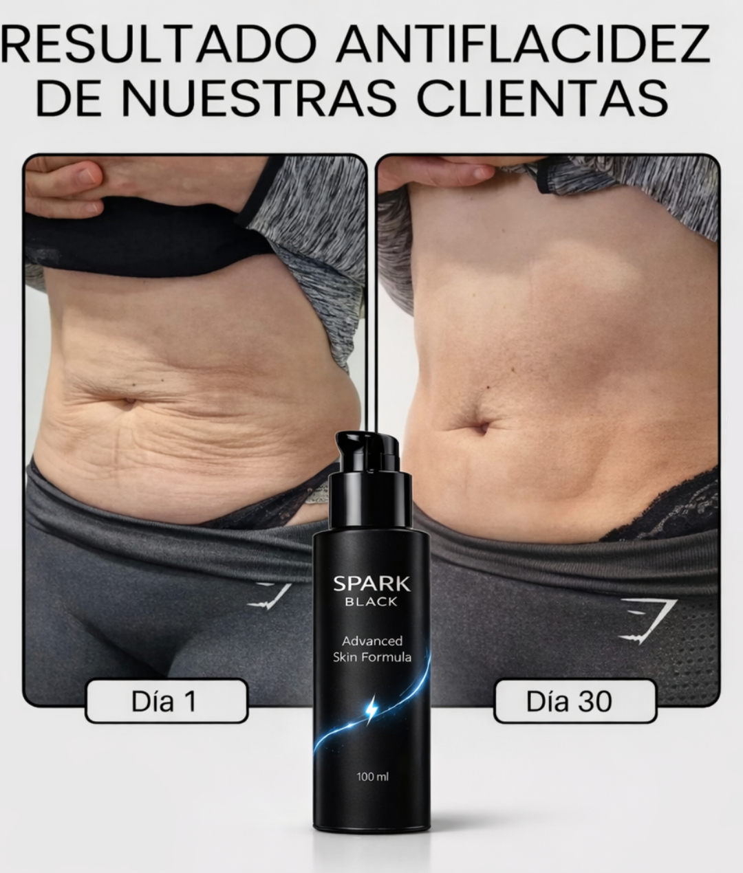 SPARK BLACK™ - Tratamiento corporal avanzado desde casa